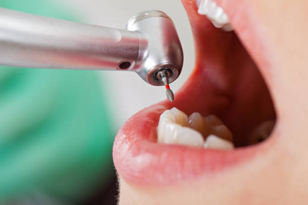Best Emergency Denture Repair in Clksville, AR